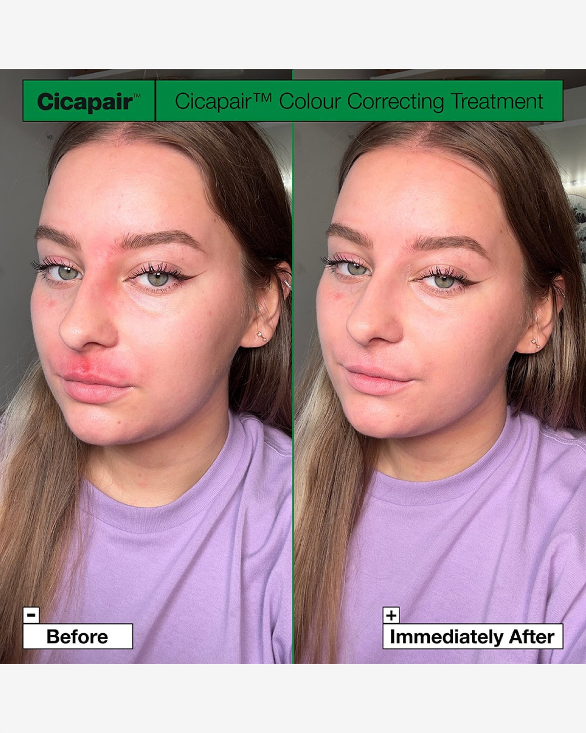 Cicapair™ Tiger Grass Colour Correcting Treatment