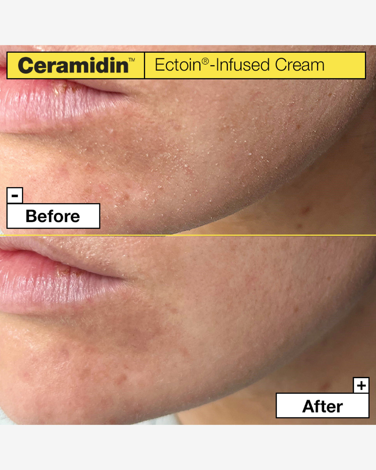 Ceramidin™ Ectoin®-Infused Cream