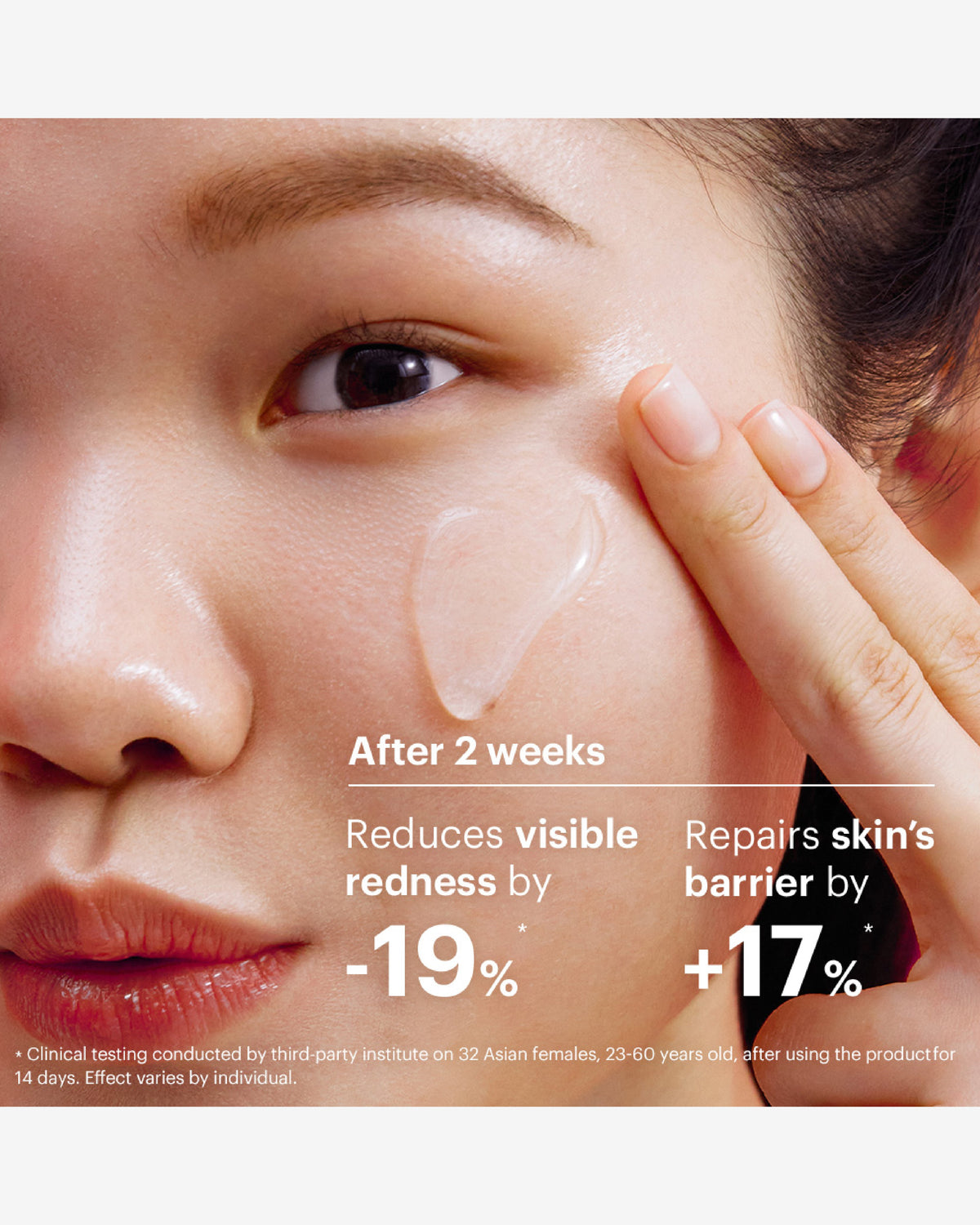 Cicapair™ Intensive Soothing Repair Treatment Lotion To Reduce Redness